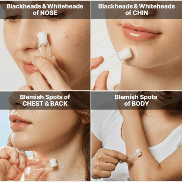 ضد جوش فوری کزرکس The AHA 2 BHA 2 Blemish Treatment Serum