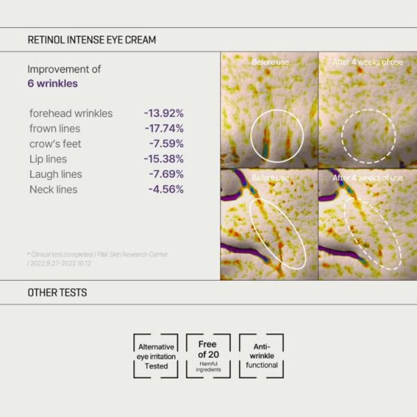 کیت رتینول اینتنس سام بای می (SOME BY MI Retinol Intense Trial Kit)